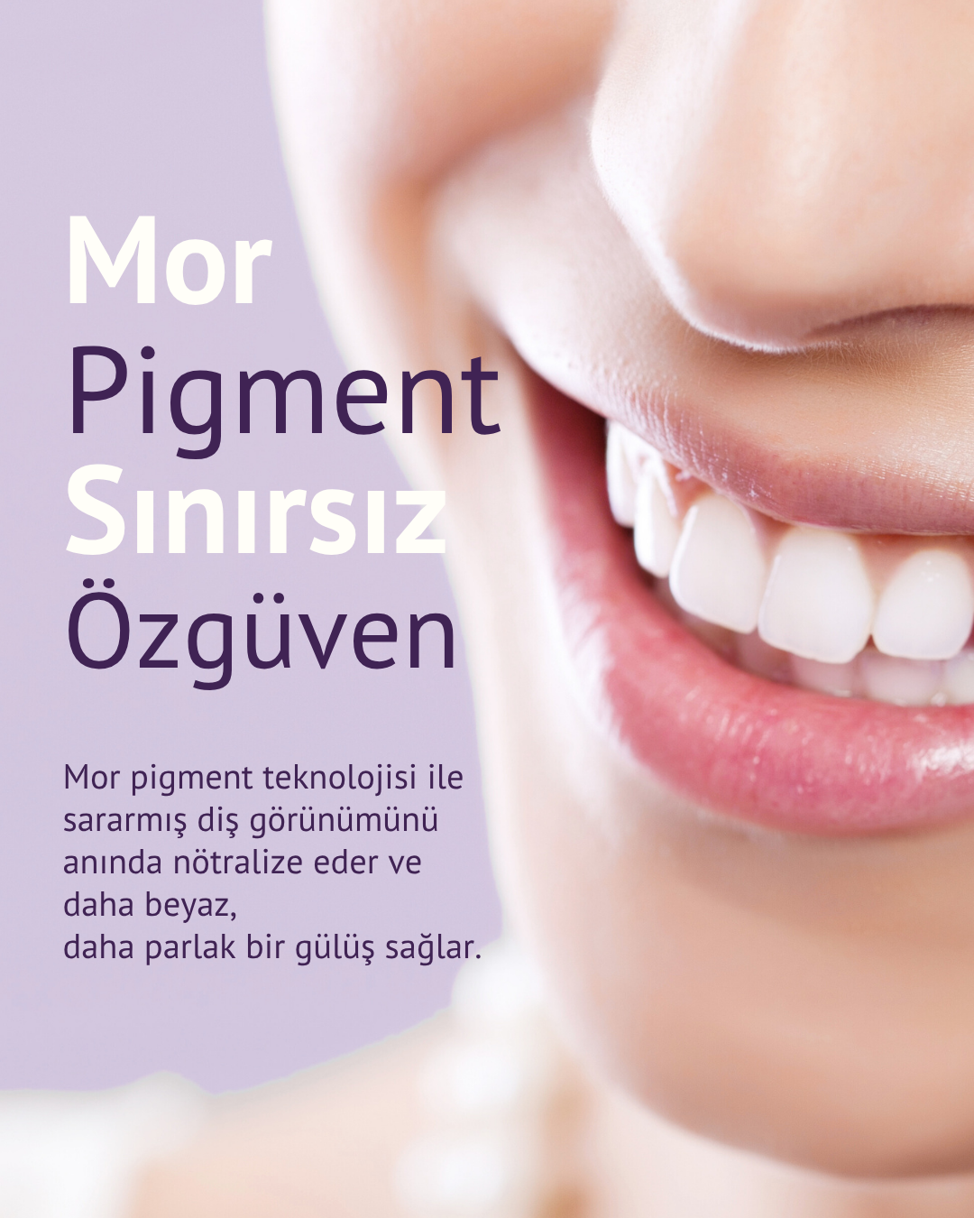 V34 Diş Beyazlatıcı Mor Pigment Jel