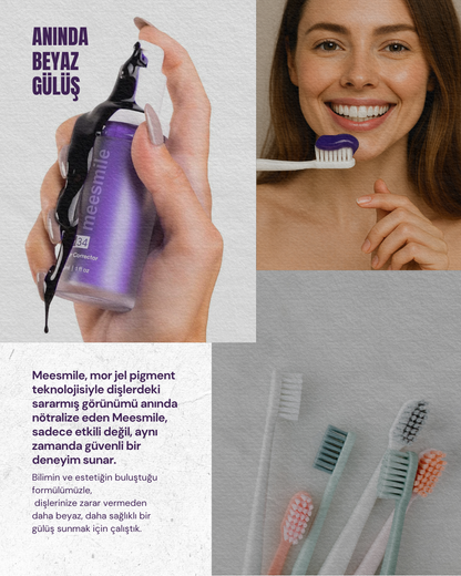 V34 Diş Beyazlatıcı Mor Pigment Jel